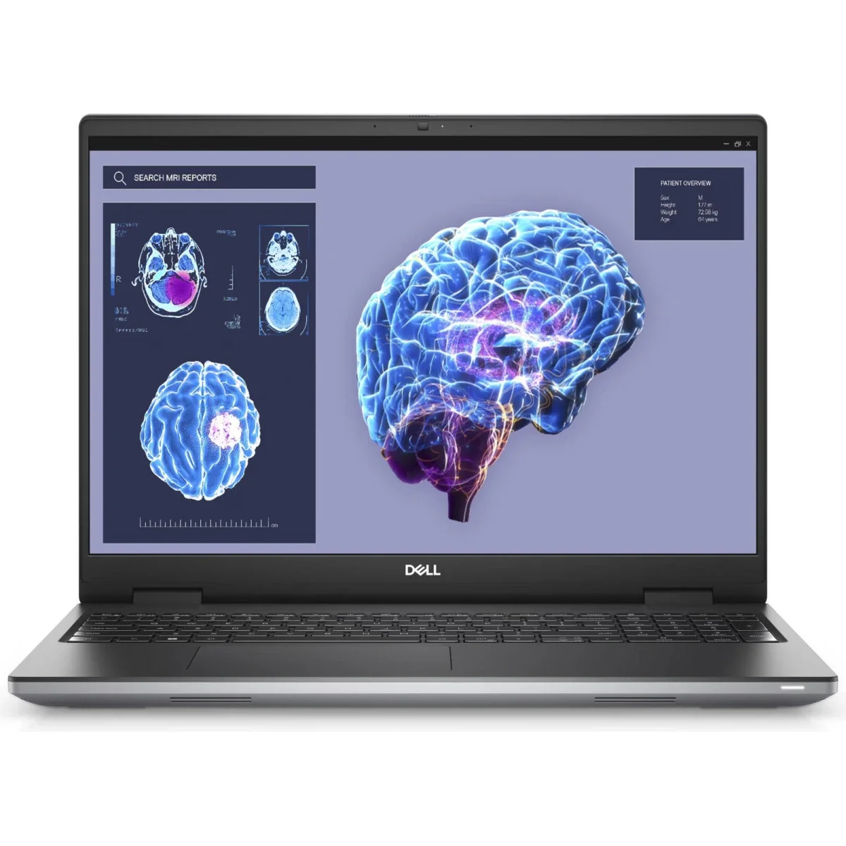 محطة عمل متنقلة Dell Precision 7680 مقاس 16 إنش، Core i7-13850HX، رام 32GB، SSD 512GB، RTX 1000 Ada